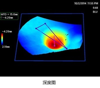 3DPM-深度圖